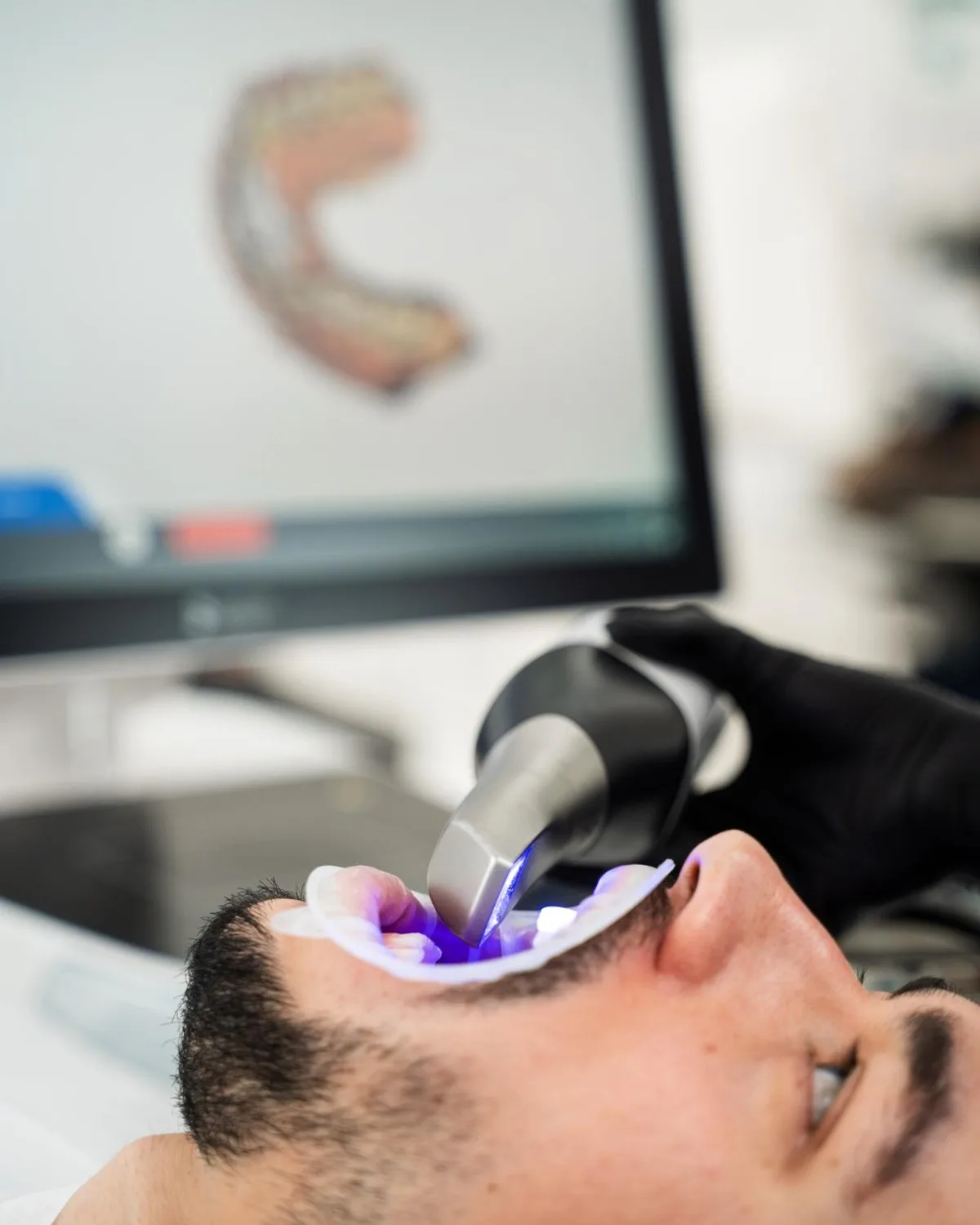 Imbasan intraoral digunakan di Ivory Dental Kepong